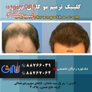 کلینیک تخصصی ترمیم مو گلهای تهران