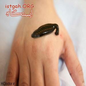 فروش زالوی طبی و زالودرمانی