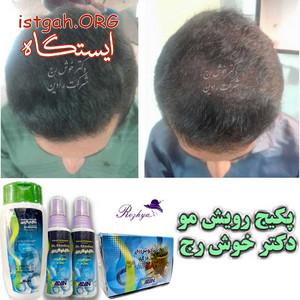 رویش مجدد مو ارثی و غیره