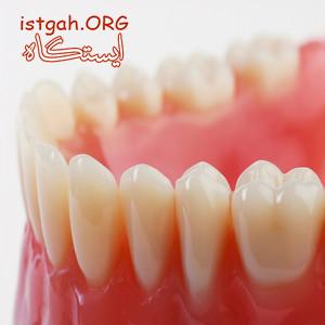 دندانسازي با بيمه